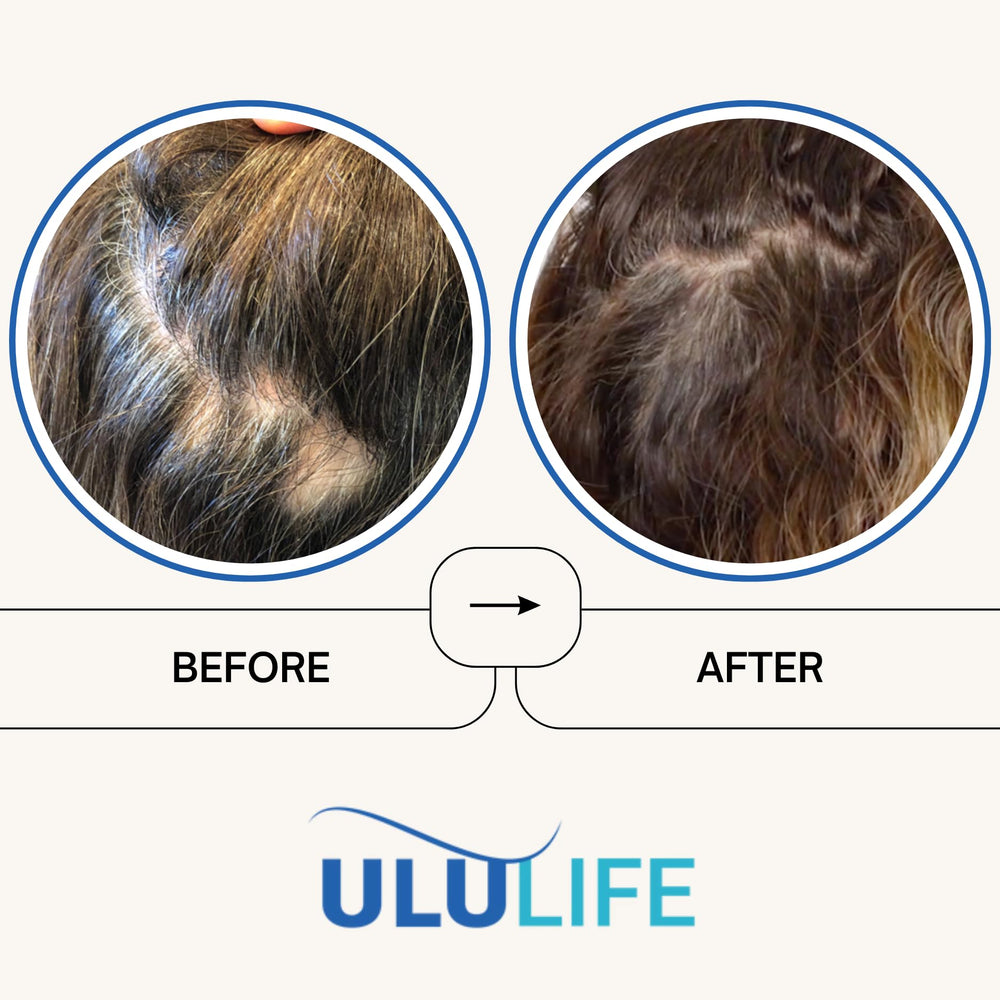ULULIFE ultimate regrow packaging image showing 360-capsule supply.