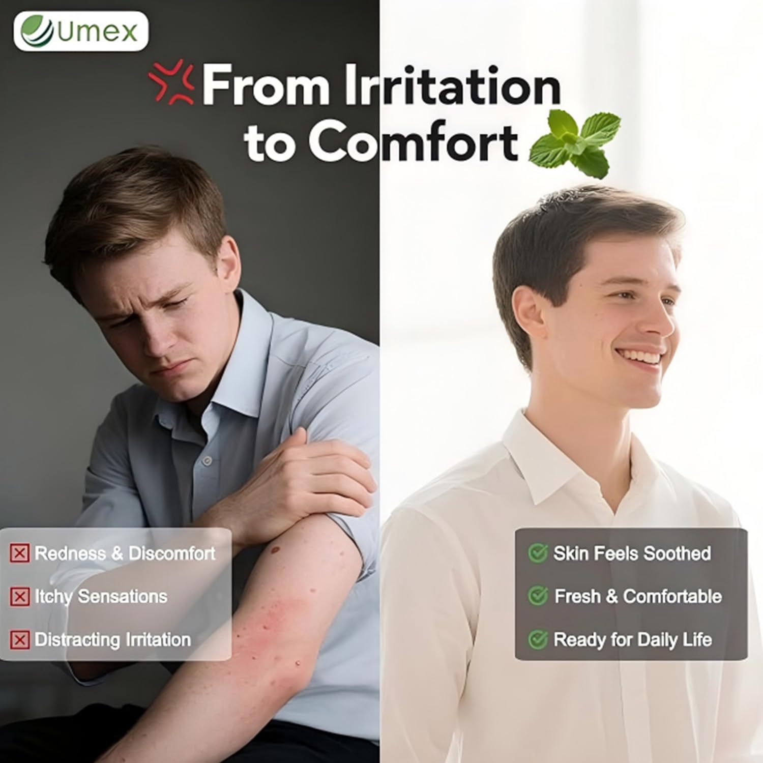Umex Intensive Itch Relief Cream in bag for portable use and quick relief