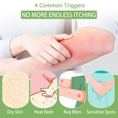 Umex Intensive Itch Relief Cream jar texture swatch on forearm