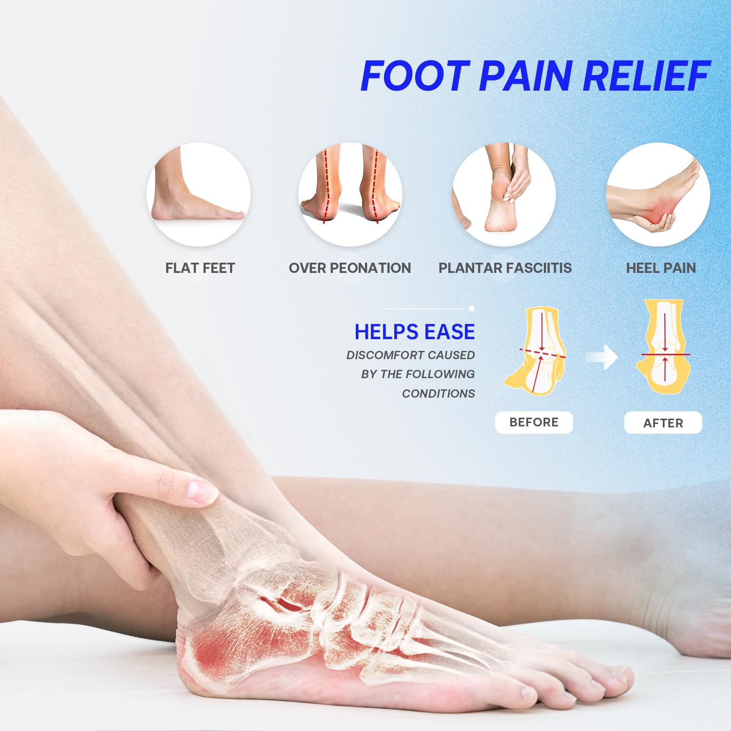 VALSOLE semi-flexible TPU arch-support frame for stable alignment