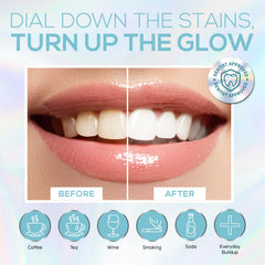 Venus Visage mouth trays fit all mouth sizes for comfortable whitening.