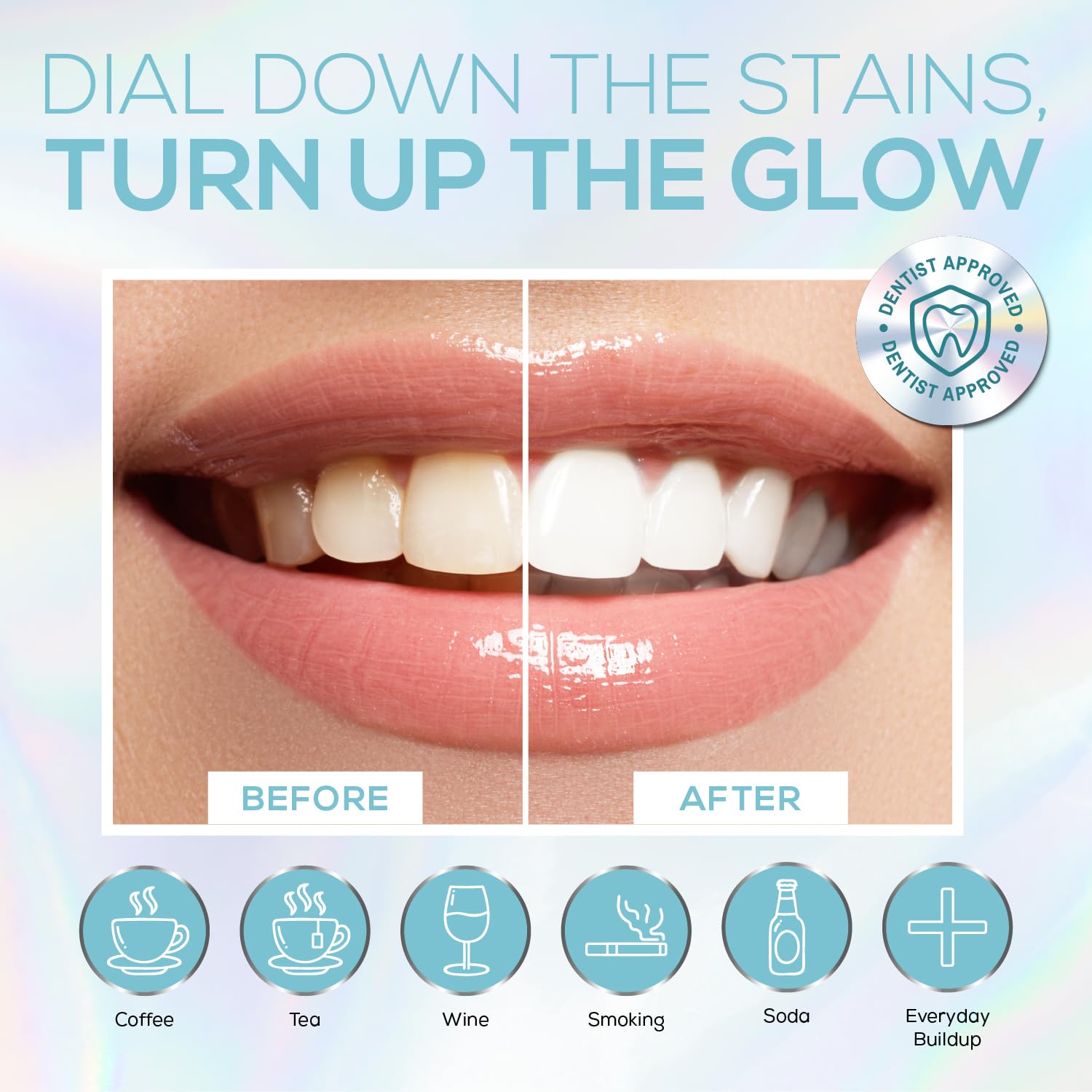 Venus Visage whitening trays provide comfortable, precise application for adults.