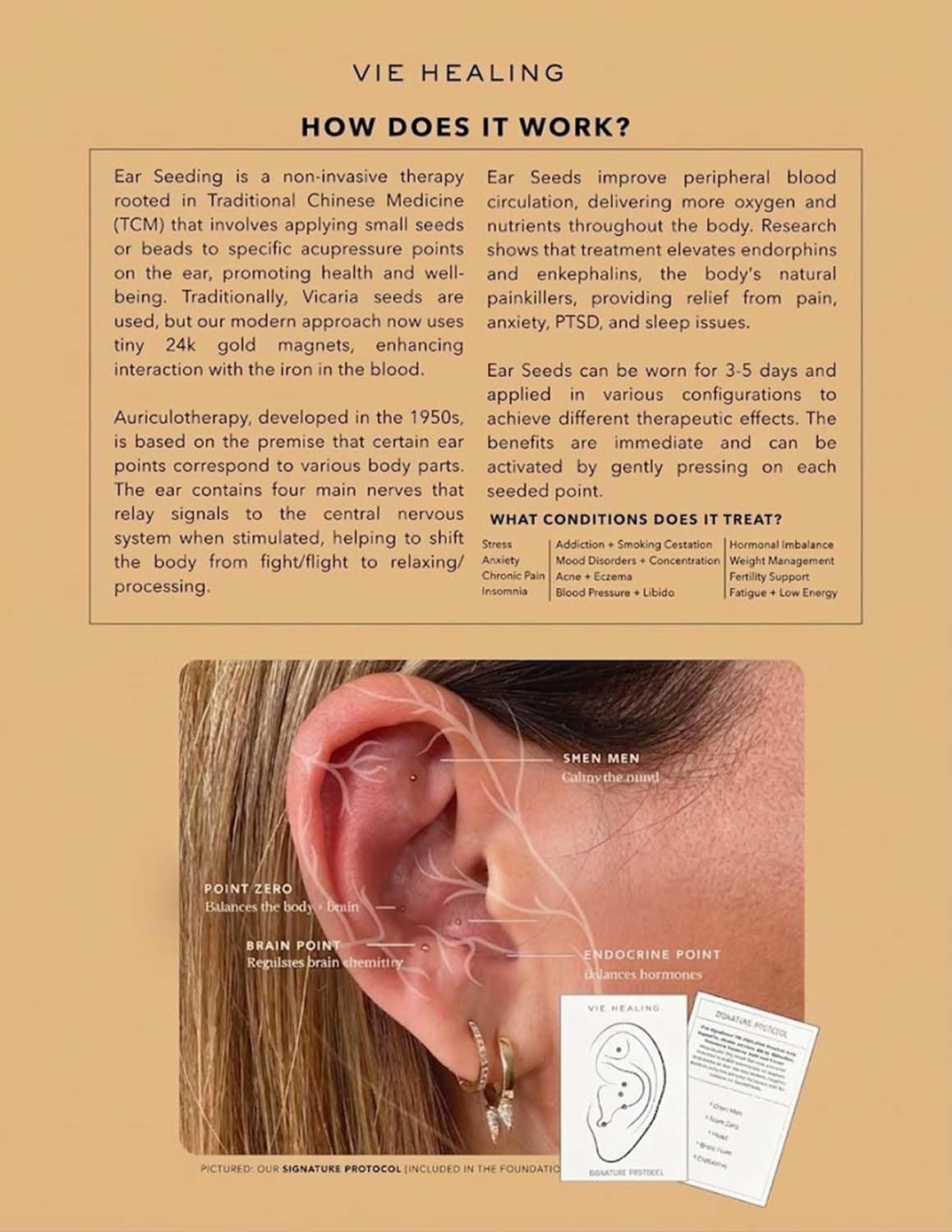 Vie Healing home auriculotherapy setup supports daily self-care.
