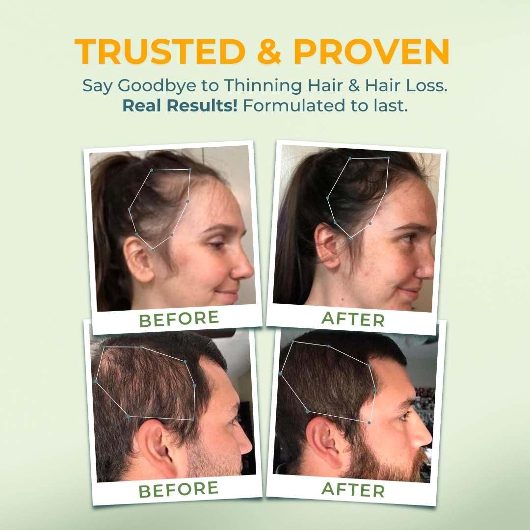 Outdoor natural light shot of Vital Hair Complex for on-the-go use.
