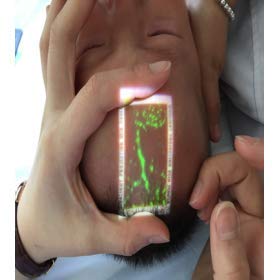 Vivolight Vein Viewer Pro compact kit, includes carry case and quick-start guidance.