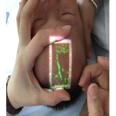 Vivolight Vein Viewer Pro compact kit, includes carry case and quick-start guidance.