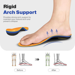 WalkHero rigid arch-support shell close-up showing durable structure.