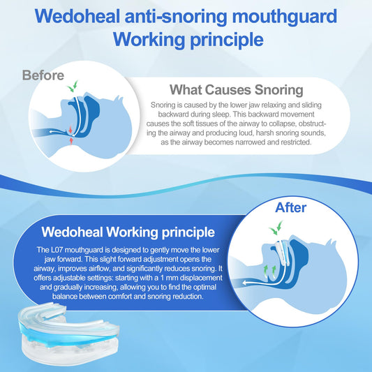 Wedoheal adjustable 0-6 mm design adapts to snoring severity.