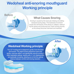 Wedoheal adjustable 0-6 mm design adapts to snoring severity.