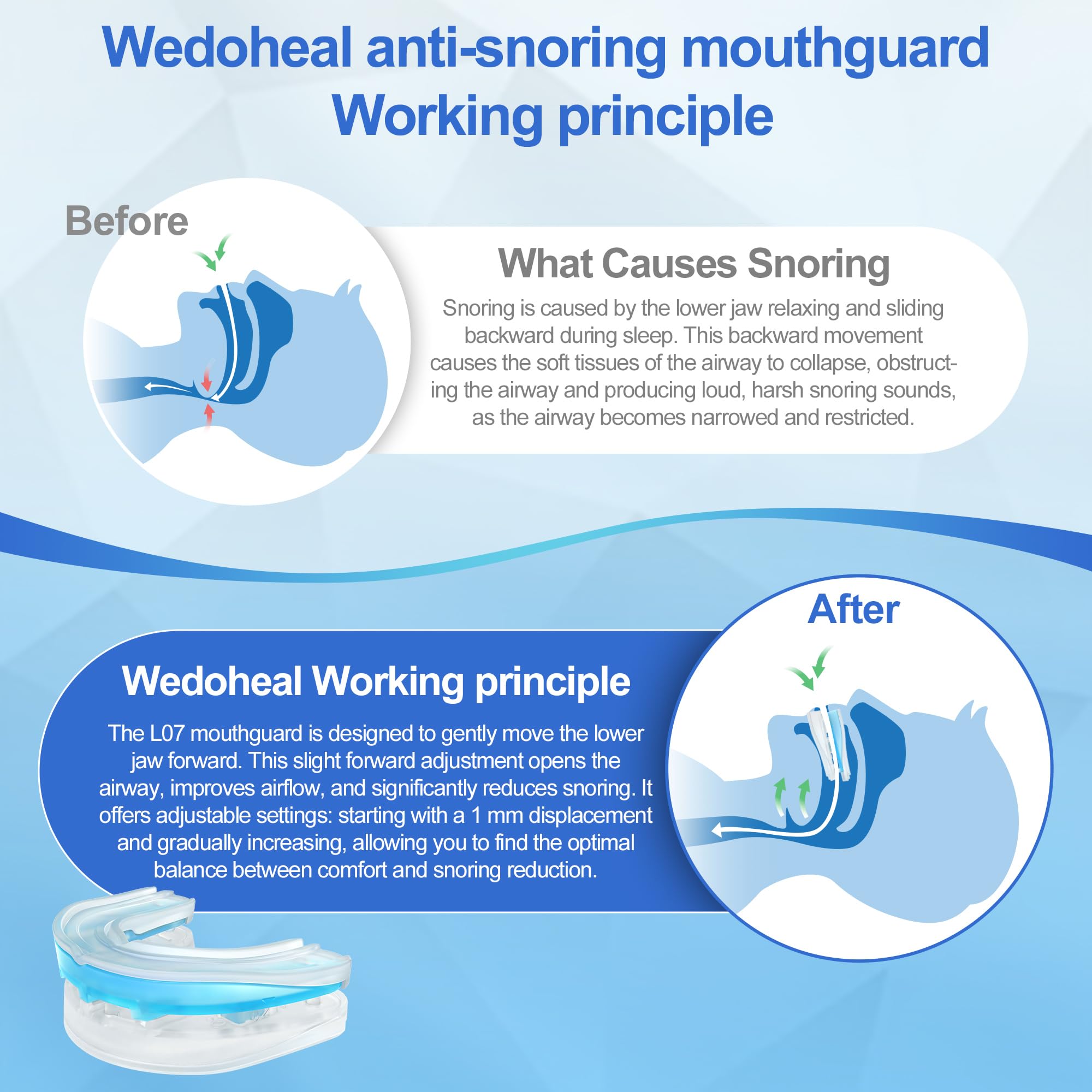 Wedoheal snap-on adjustment for quick, tool-free fitting.