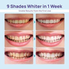 Whitebite Pro dual LED in operation for faster stain reduction at home.