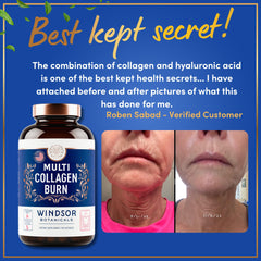 WINDSOR BOTANICALS Hyaluronic acid closeup demonstrates skin hydration potential.