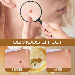 WoTeReVo ointment absorption on skin shows quick, comfortable uptake.