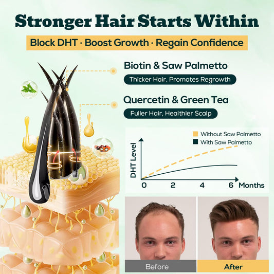 YLVARIN THORIA Saw Palmetto Gummies label close-up shows high-strength formula