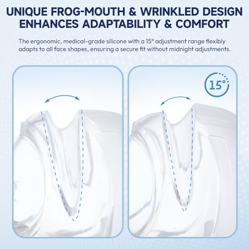 Frog-mouth design cushion adapts to many face shapes with Yosopherier