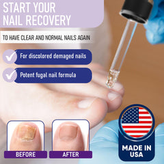ZanaQuick nail recovery drops application demonstrates easy daily use for healthier nails.