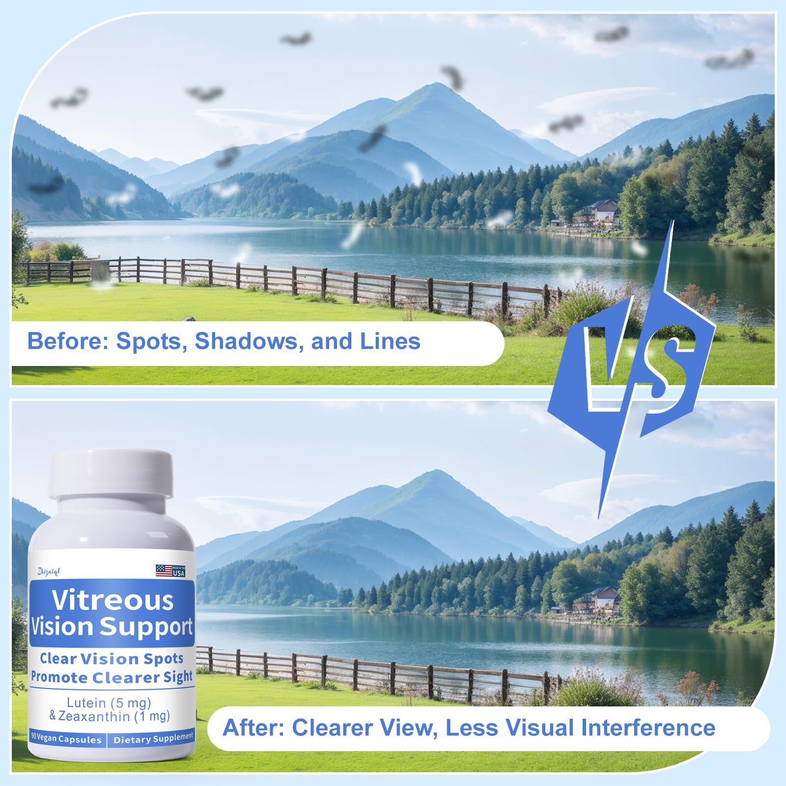 Zhizaiql Eye Vitamin packaging displays 90 vegan capsules for ongoing eye support.