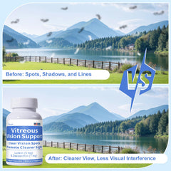 Zhizaiql Eye Vitamin packaging displays 90 vegan capsules for ongoing eye support.