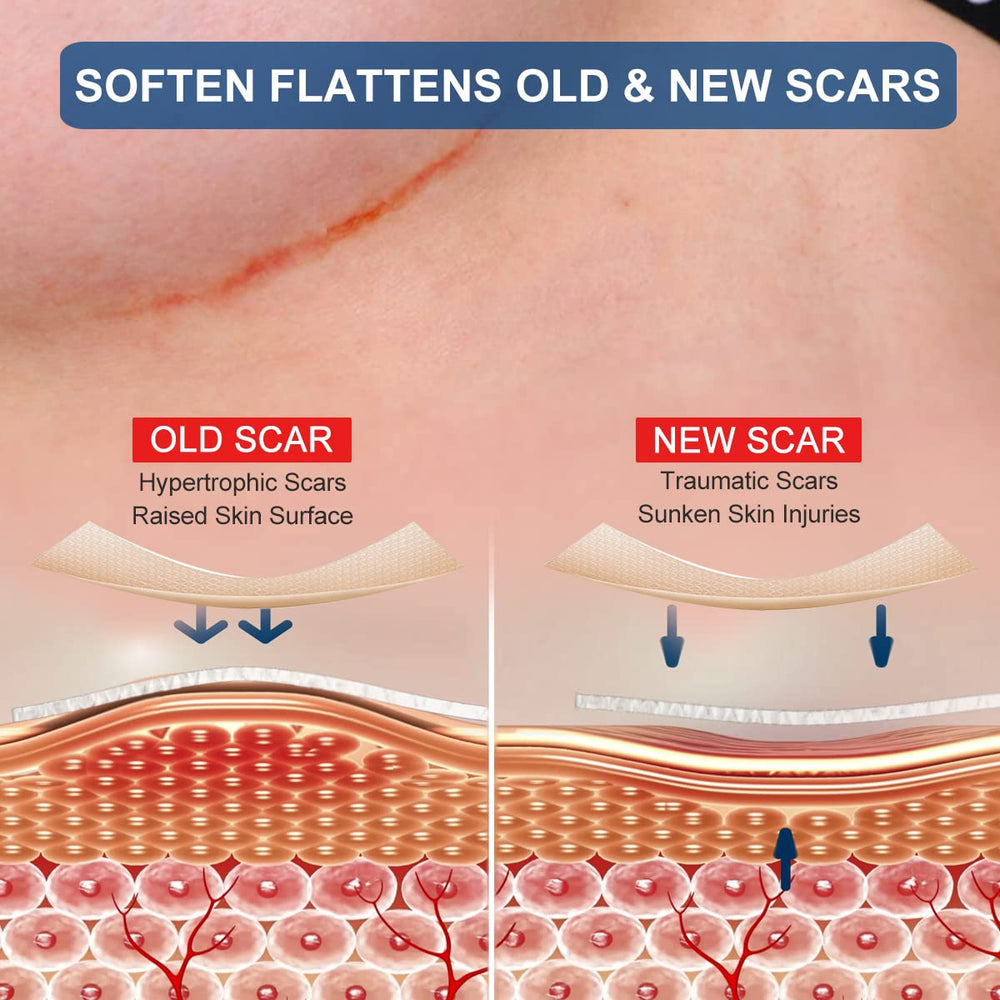 ZODENIS breast scar sheets anchor sheets provide flexible support for post-surgical scars.