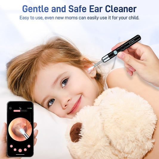 Zupora ear cleaner ip67 lens for durable waterproof cleaning sessions.
