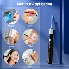 Zupora kit includes mirror light and tools for versatile ear cleaning.
