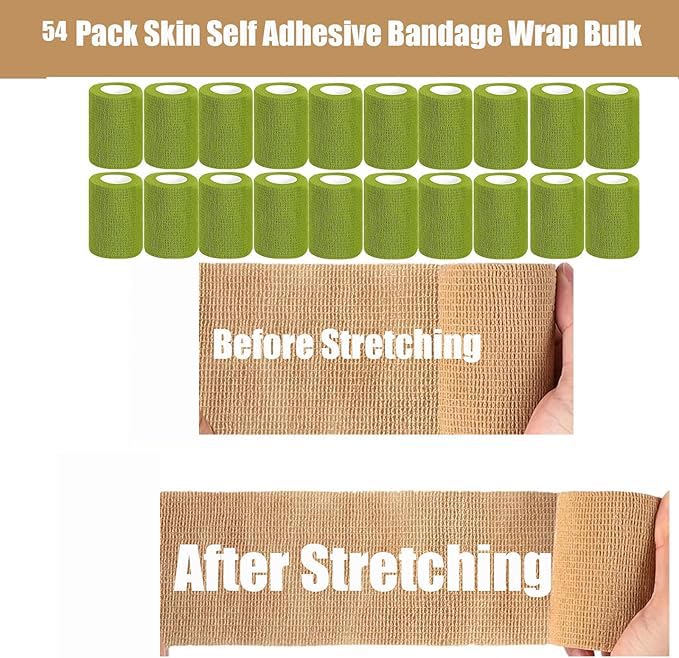 Zwealthygift self-adherent wrap tears by hand for easy application.