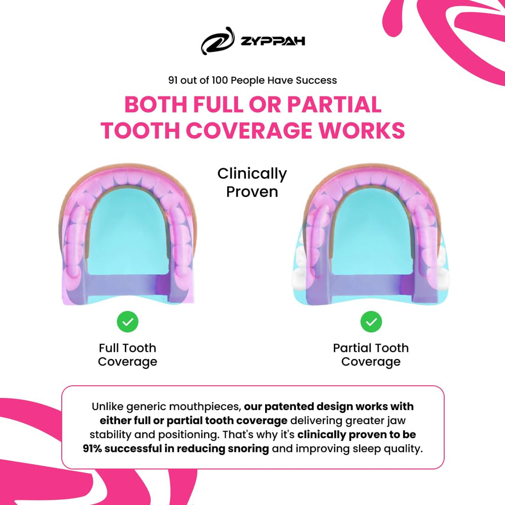ZYPPAH tongue strap detail illustrating unique airway-support feature